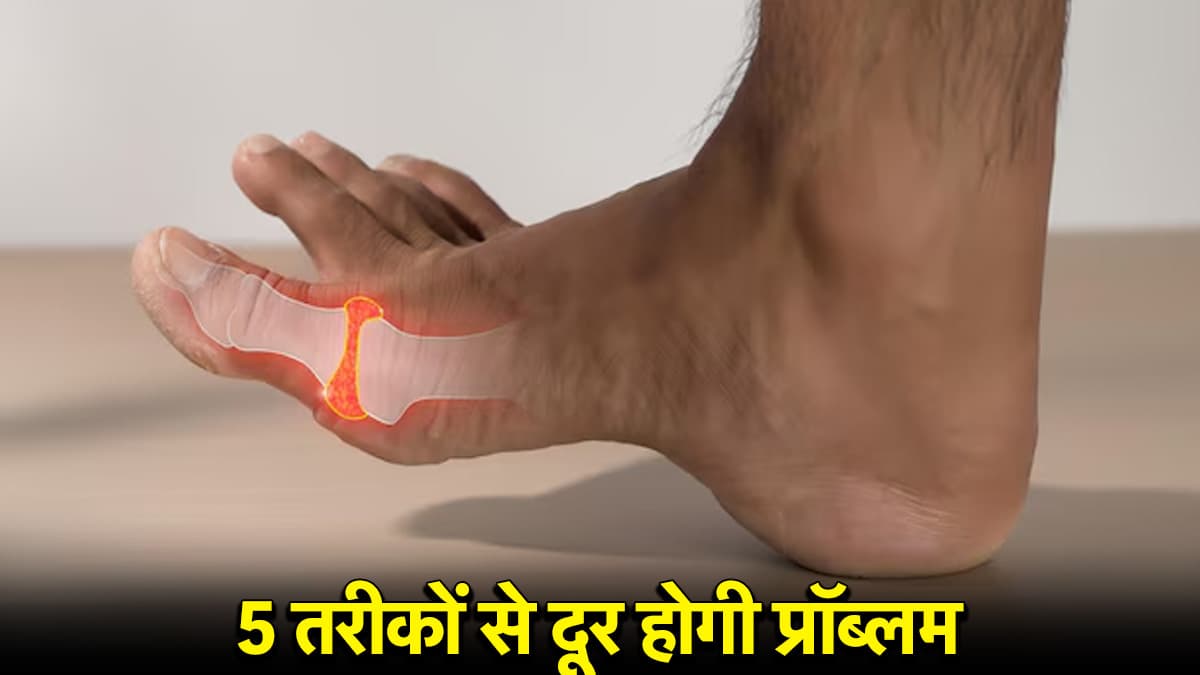 Uric Acid Reducing Tips: यूरिक एसिड को कंट्रोल करेंगे ये 5 आसान टिप्स, किडनी भी रहेगी फिट