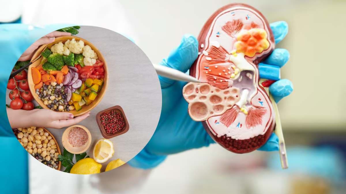 Kidney Stone Causes: सर्जरी के बाद दोबारा पथरी होने का खतरा क्यों? जानें डॉक्टर की राय
