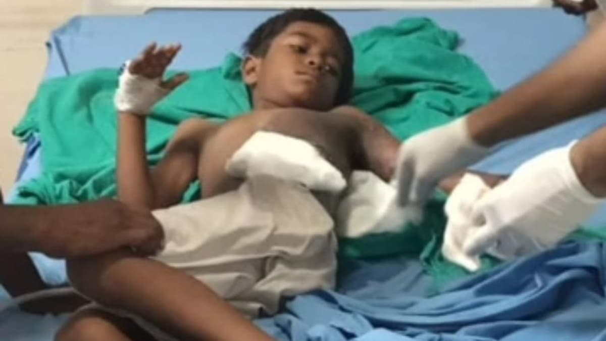 Child Injured