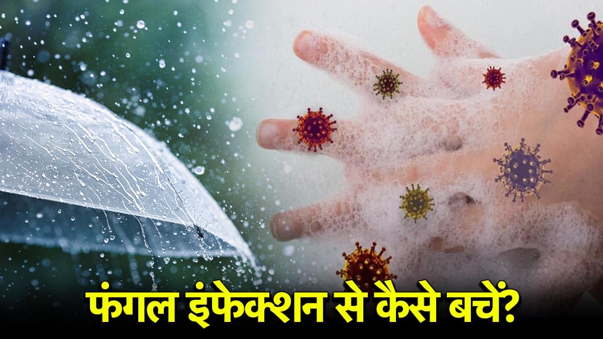 Monsoon Health Tips: फंगल इंफेक्शन से बचने के लिए अपनाएं ये 5 घरेलू उपाय, मानसून में नहीं होगी प्रॉब्लम