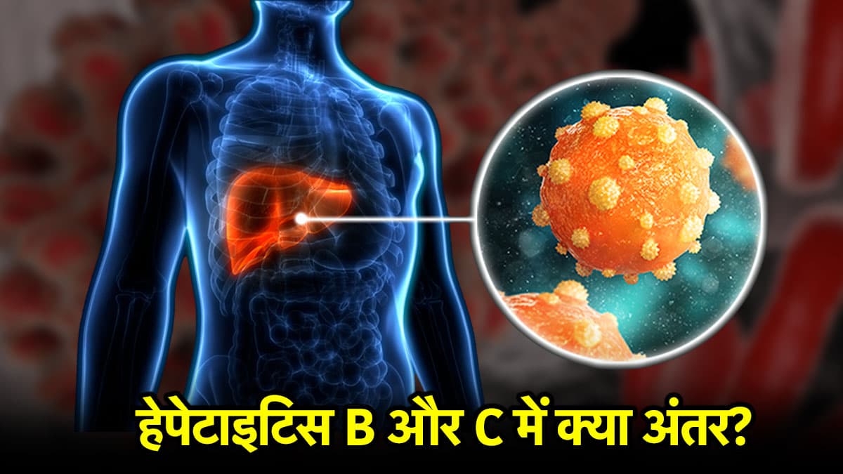 हेपेटाइटिस के 5 प्रकार कैसे होते हैं? सबसे ज्यादा खतरनाक कौन सा, जानिए डॉक्टर से