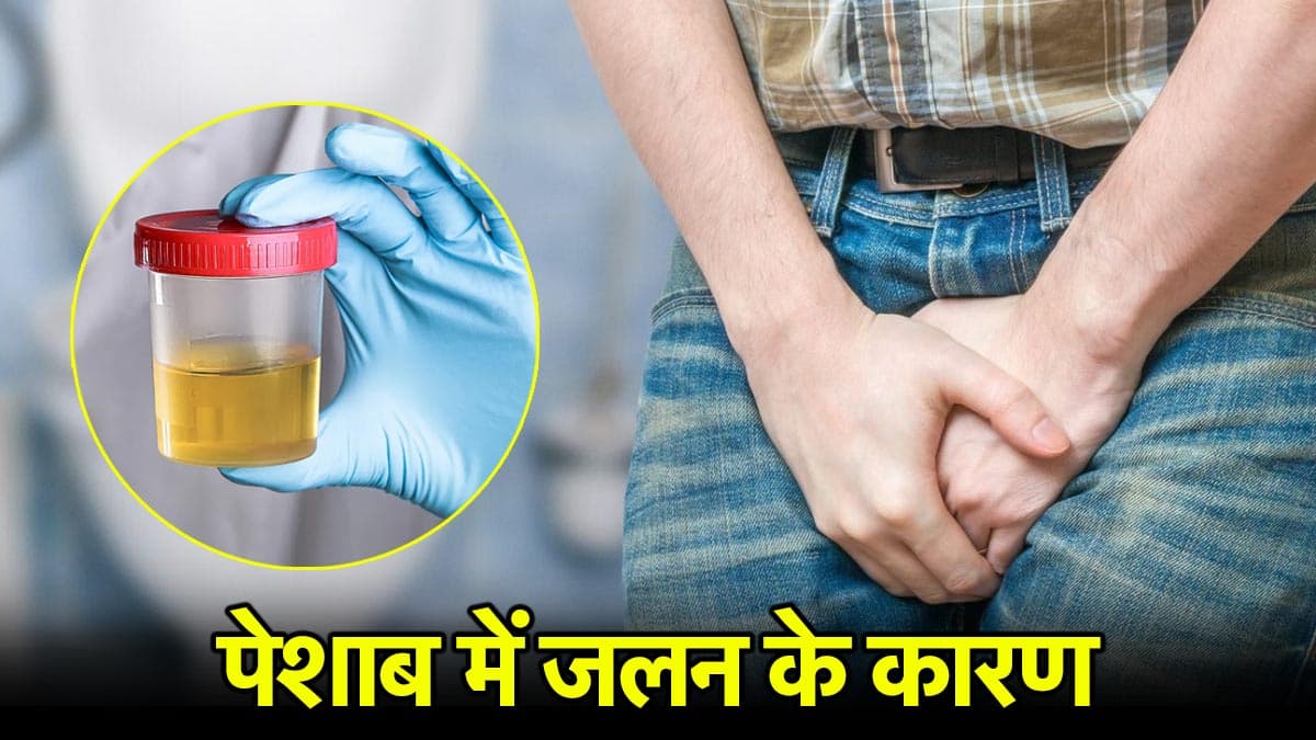 पेशाब करते वक्त जलन होना है कई गंभीर बीमारियों का संकेत, डाक्टर से जानें इलाज