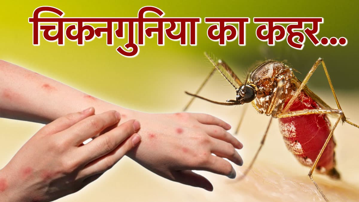 चीन में चिकनगुनिया से मची 'तबाही', 7000 नए केस मिले, जानें लक्षण और बचाव