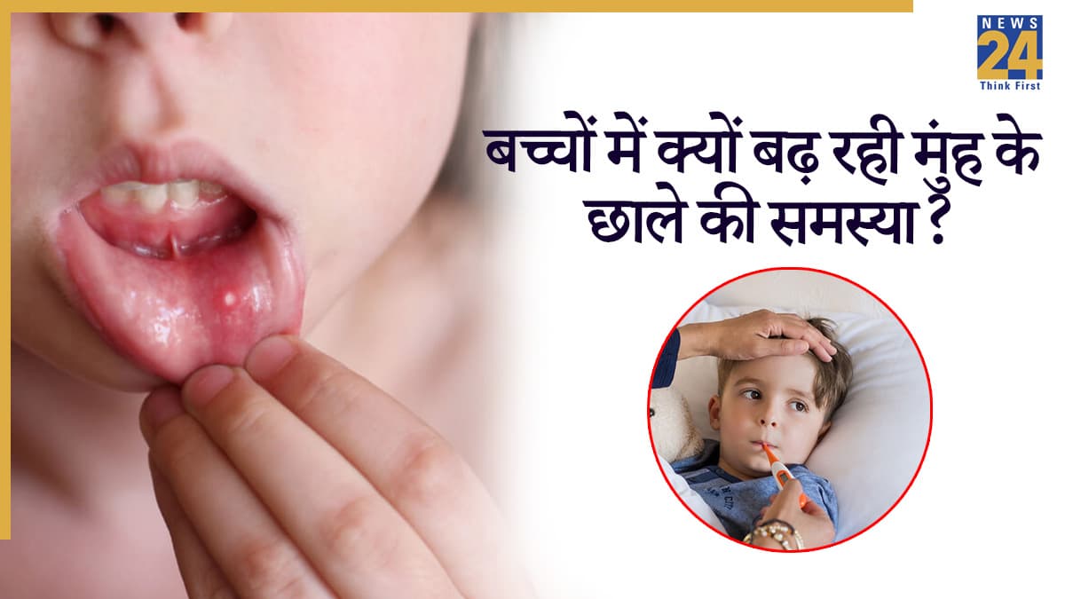 छोटे बच्चों में फैल रही है मुंह के छालों की बीमारी, इन राज्यों में मिले मामलें, जानें कारण, लक्षण और बचाव