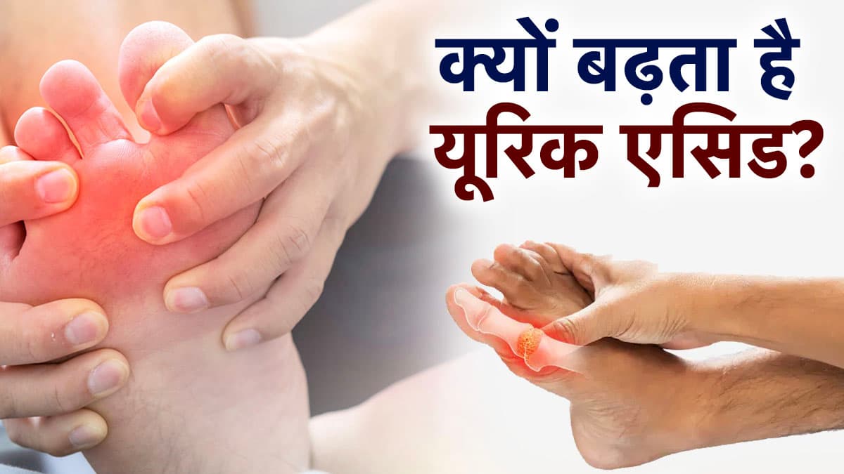 हर दिन की ये 5 आदतें बढा रही हैं यूरिक एसिड का खतरा, एक्सपर्ट से जानें बचाव के टिप्स