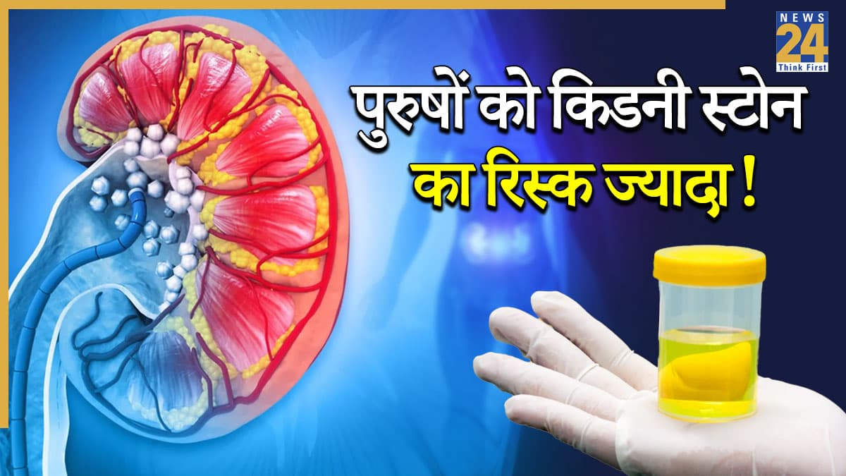 महिलाओं और पुरुषों में किडनी स्टोन के संकेत कैसे होते हैं अलग? जानें कारण और दर्द में अंतर