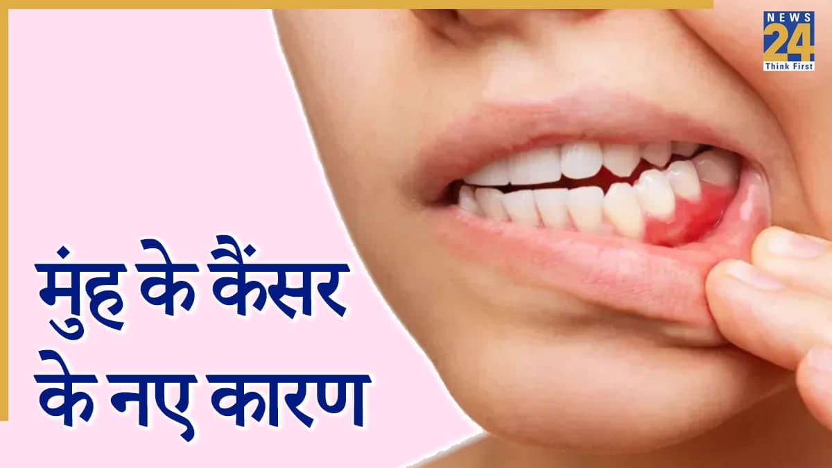 मुंह का कैंसर होने के ये 2 कारण बिल्कुल नए, एक्सपर्ट से जानिए क्या है सही बचाव के उपाय