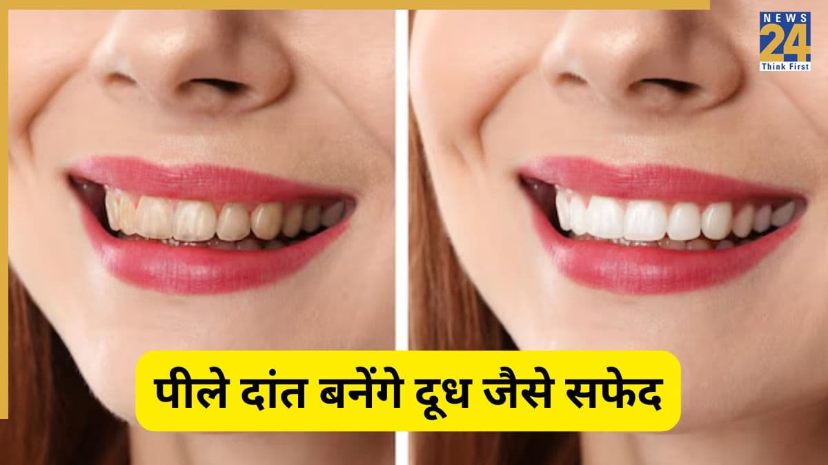 दांतों पर इस तरह लगा ली फिटकरी तो पीलापन हो जाएगा दूर, मोतियों से चमकने लगेंगे पीले दांत