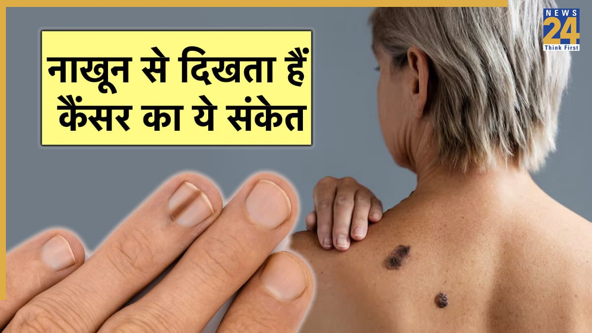 नकली नाखून लगाने से भी बढ़ता है कैंसर का खतरा, डॉक्टर से जानें शुरुआती संकेत और बचाव