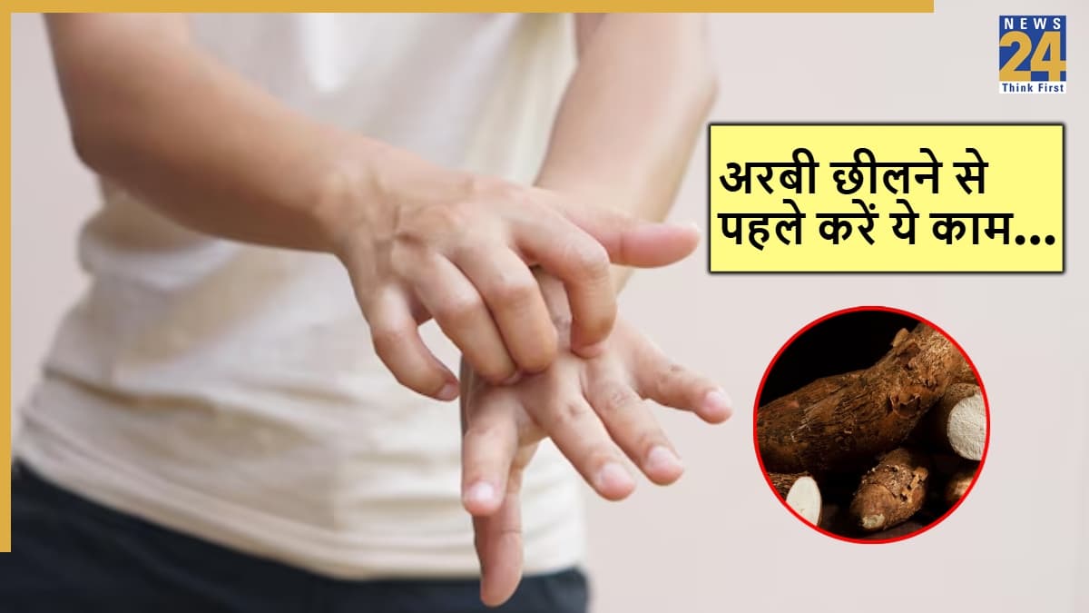 Kitchen Tips: अरबी छीलने पर हाथों में होती है खुजली, इन 5 तरीकों से काटेंगे तो नहीं होगी परेशानी