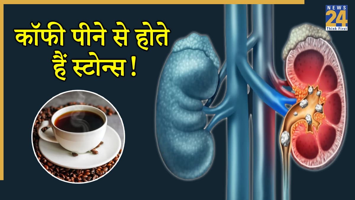 International Coffee Day: ज्यादा कॉफी पीने से क्या पथरी होती है? डॉक्टर से जानें सच्चाई