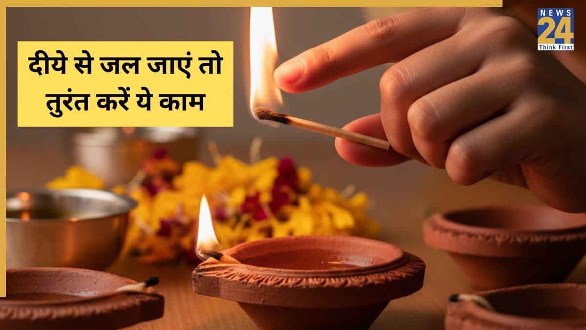 दीये से जल जाए हाथ तो तुरंत करें ये काम, डॉक्टर ने कहा जलने पर याद रखें ये 3 C, नहीं पड़ेगा निशान