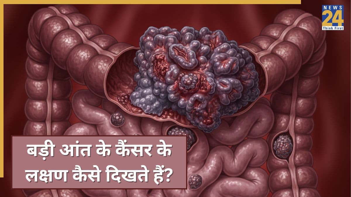 बड़ी आंत के कैंसर के क्या लक्षण हैं? जानिए Colorectal Cancer में शरीर में क्या बदलाव नजर आते हैं