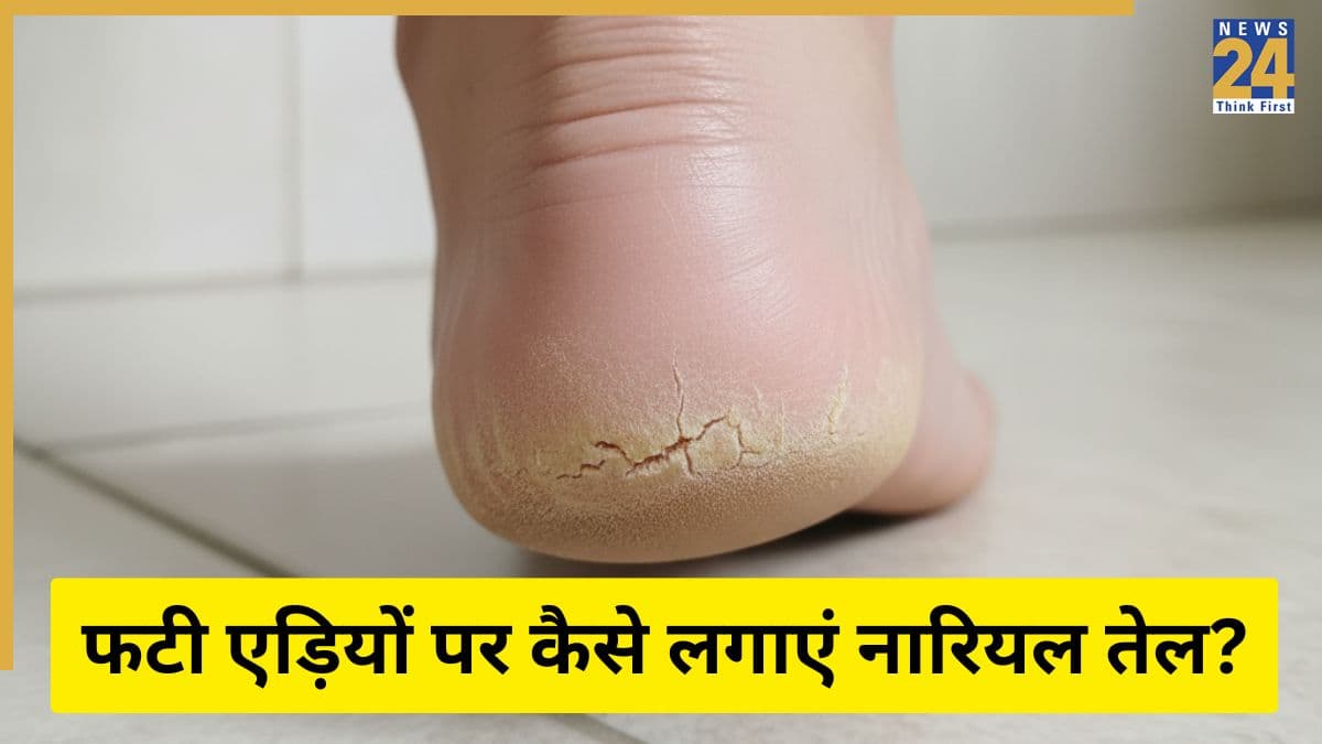 फटी एड़ियों पर इस तरह लगा लिया नारियल तेल तो भर जाएंगी Cracked Heels, रूई की तरह मुलायम हो जाएगी त्वचा