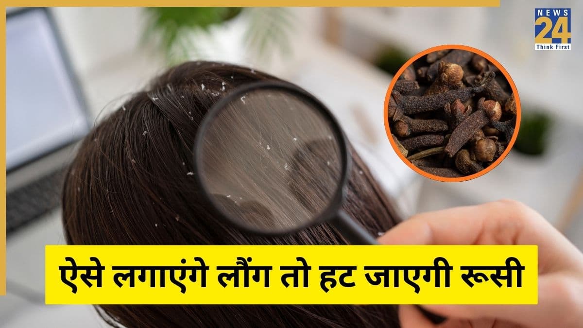 4 लौंग के टुकड़े रूसी को हटा देंगे जड़ से, Dandruff के लिए तुरंत आजमाकर देख लें यह नुस्खा