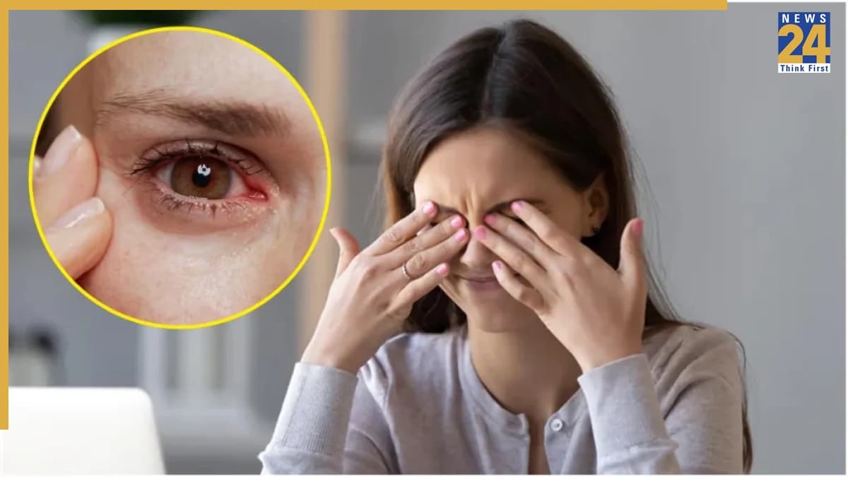 Greater Noida News: दिवाली में 10 मीटर दूर से करें आतिशबाजी, आंखों की रोशनी हो सकती है धुंधली