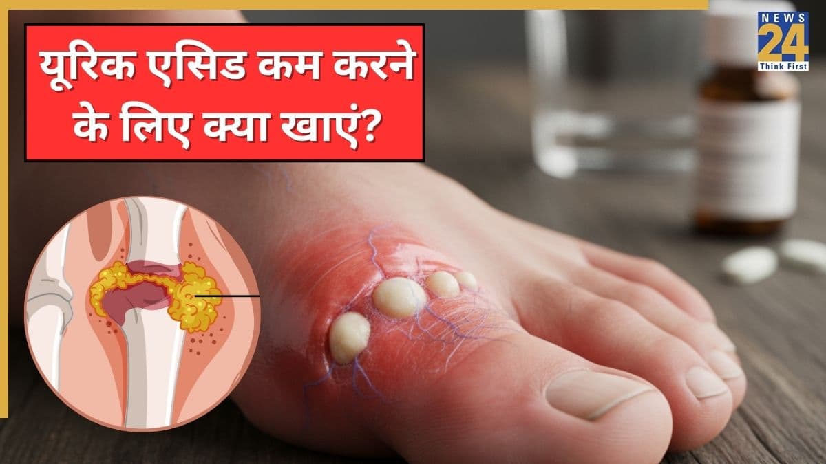 यूरिक एसिड को जड़ से खत्म करने के लिए क्या खाना चाहिए? मूत्र रोग विशेषज्ञ ने बताए तेल से लेकर फलों तक के नाम