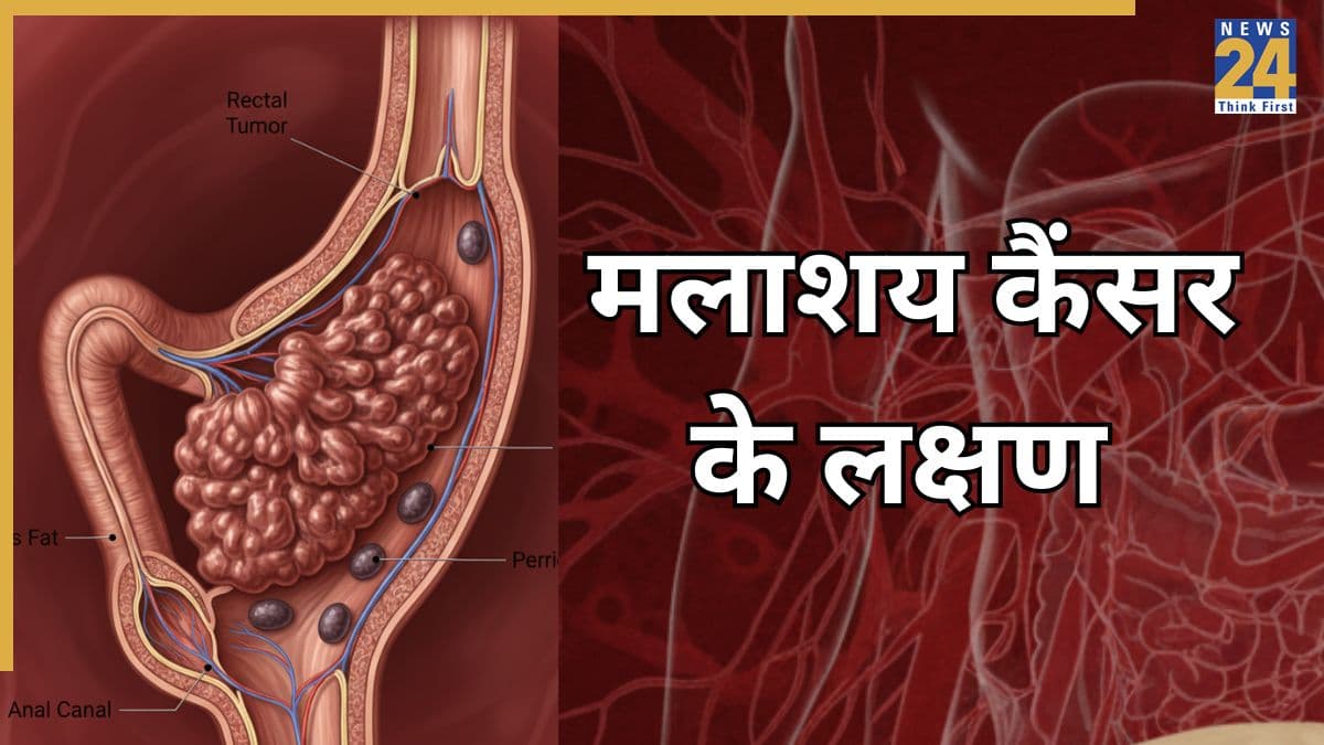 मलाशय का कैंसर होने के क्या लक्षण हैं? कैंसर सर्जन ने बताया Rectal Cancer का कैसे होता है इलाज