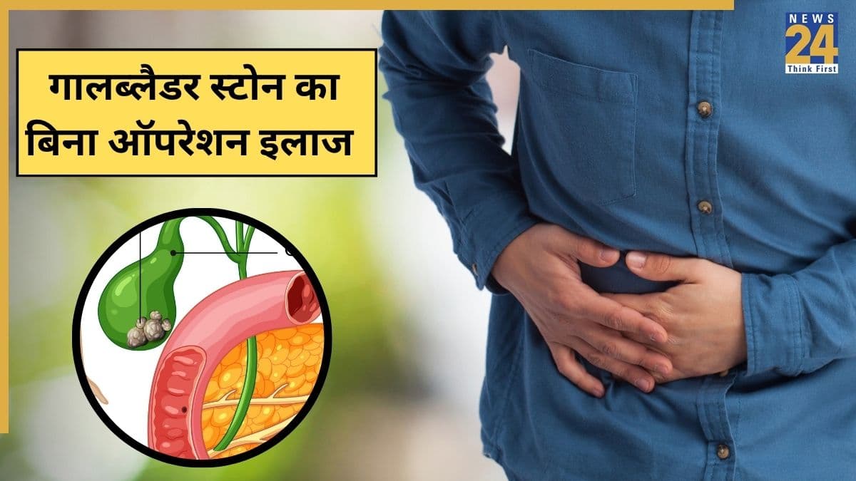 पित्त की थैली में पथरी का बिना ऑपरेशन कैसे होगा इलाज? सीनियर गैस्ट्रोएंटेरोलॉजिस्ट ने बताया Gallbladder Stones हटाने का तरीका