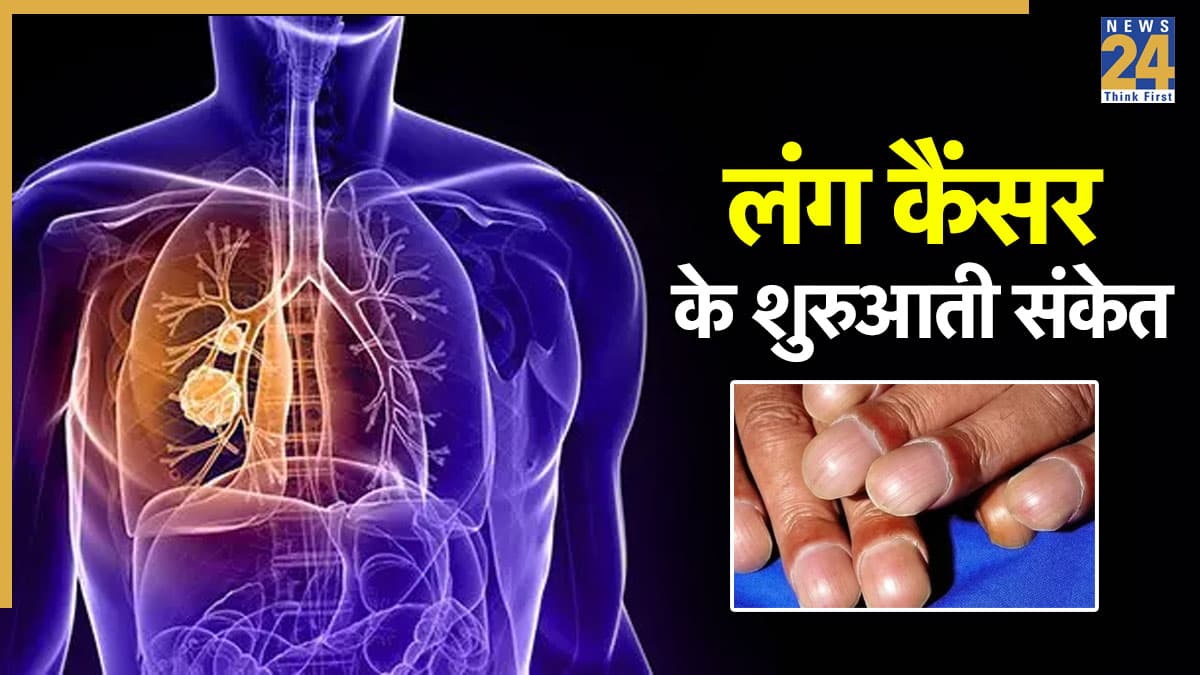नाखूनों में दिखने लगते हैं लंग कैंसर के शुरुआती संकेत, डॉक्टर से जाने पहचानने का तरीका