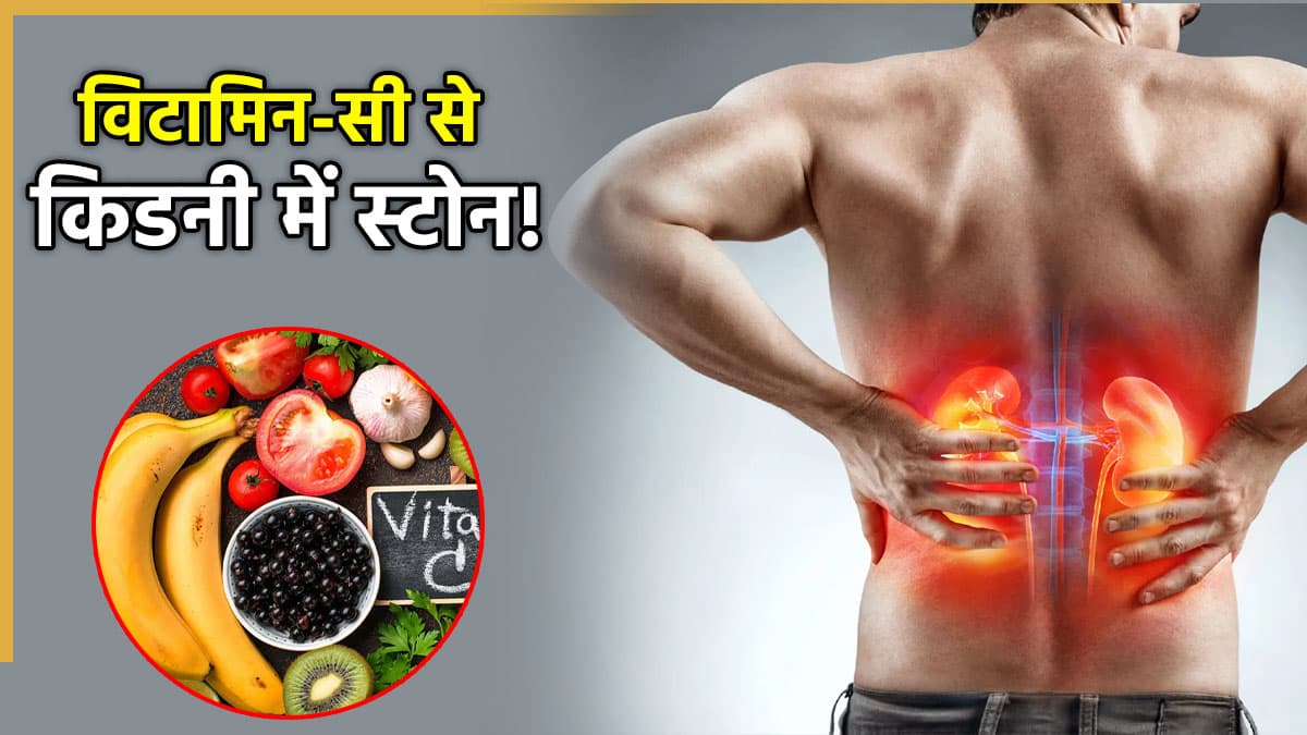 शरीर में विटामिन-C के ज्यादा होने से क्या किडनी भी हो सकती है खराब? एक्सपर्ट से जानें
