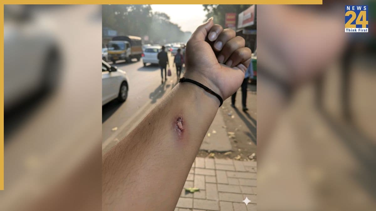 नौकरी बाद में छीनेगा AI… पहले छुट्टी दिलाने में कर रहा मदद, हाथ पर बनाया चोट का ऐसा निशान, HR ने मान लिया सच