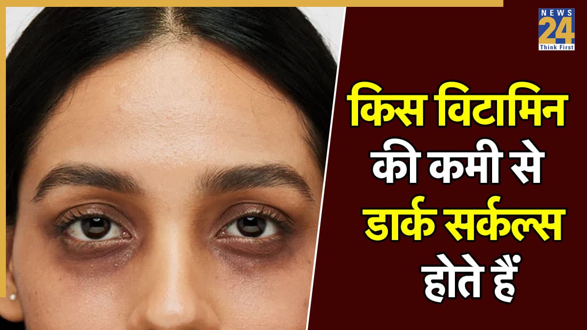 किस विटामिन की कमी से डार्क सर्कल्स होते हैं, यहां जानिए Dark Circles होने के क्या-क्या हैं कारण