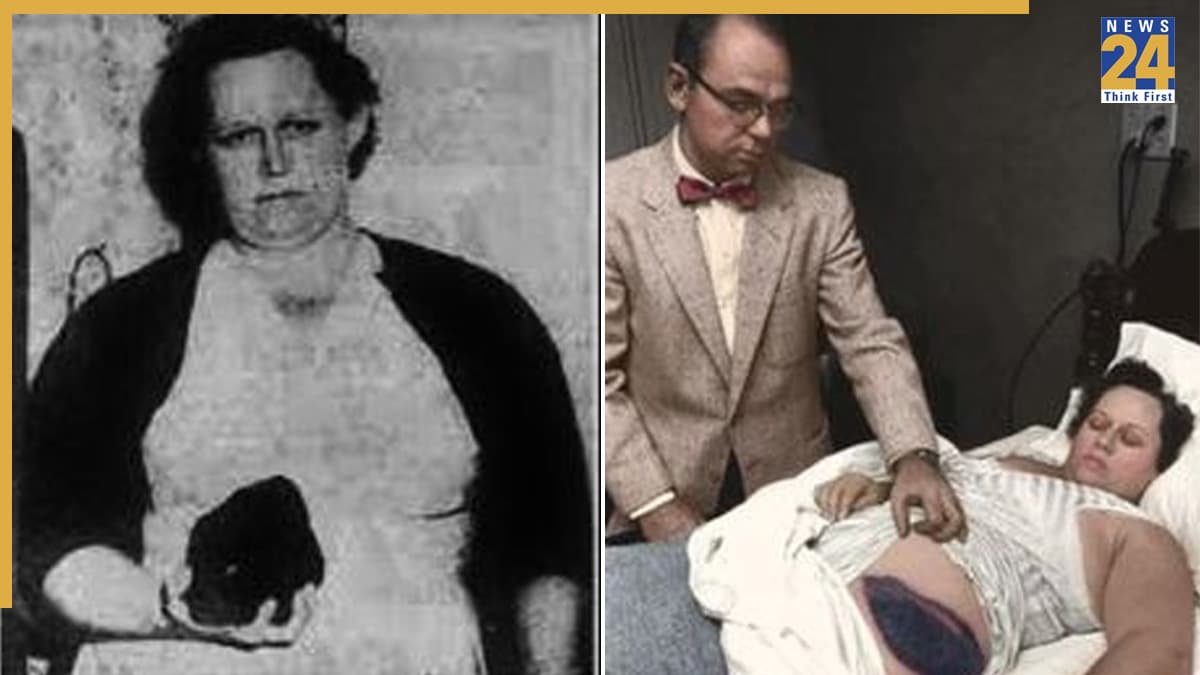 वो स्त्री है…! दुनिया की पहली महिला, जिसके ऊपर आकर गिरा उल्कापिंड, फिर भी बच गई जिंदा; वैज्ञानिक हैरान