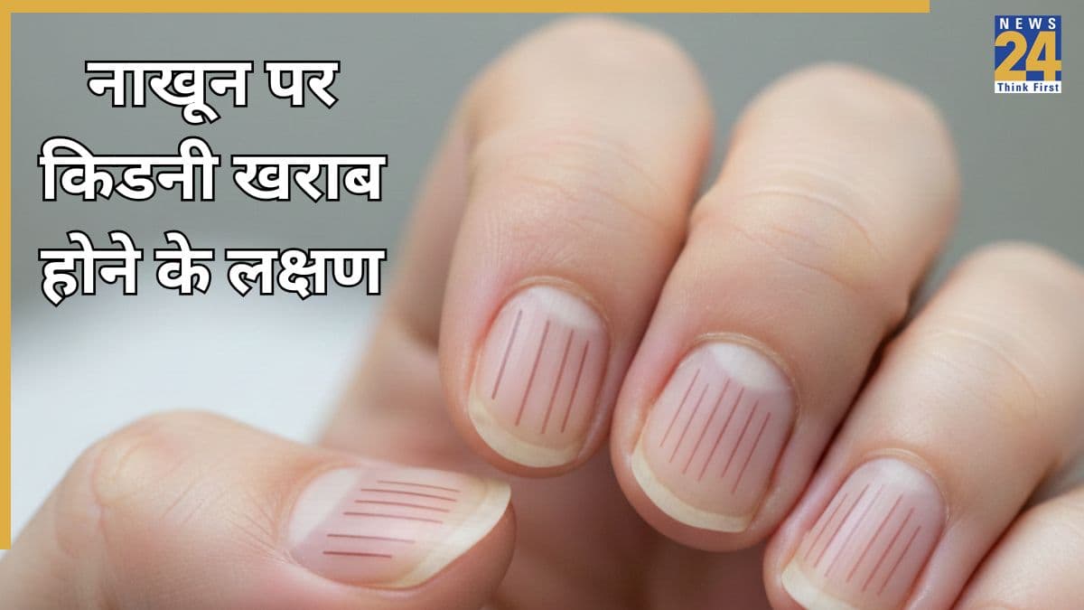 किडनी की बीमारी में नाखून कैसे दिखते हैं? यहां जानिए किडनी खराब होने के शुरुआती लक्षण क्या हैं