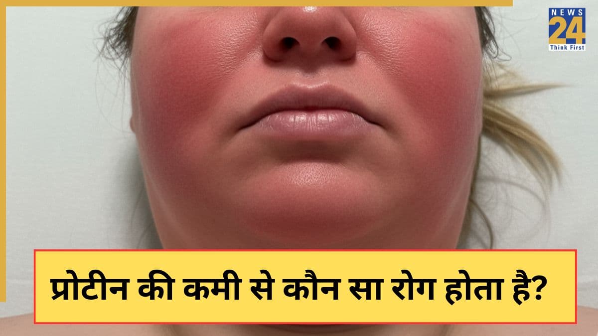 प्रोटीन की कमी से कौन-कौन से रोग होते हैं? यहां जानिए कौन सी 7 चीजें खाने पर शरीर को मिलेगा Protein