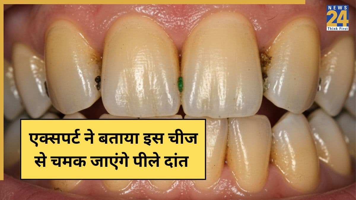 क्या पीले दांत फिर से सफेद हो सकते हैं? एक्सपर्ट ने कहा टूथपेस्ट में मिलाकर लगा लें ये चीज, चमक जाएंगे Yellow Teeth