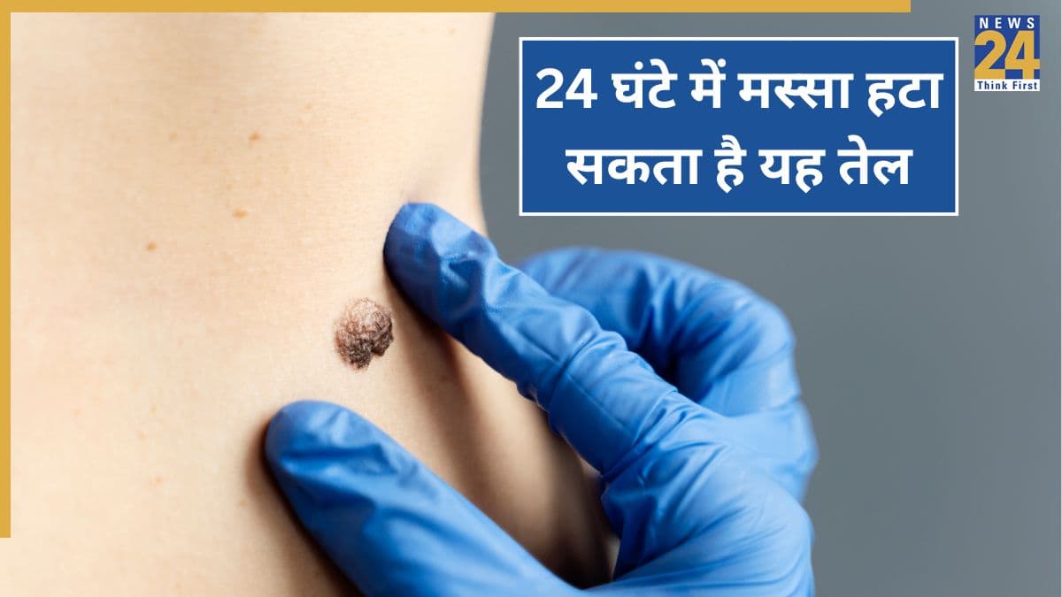 24 घंटे में मस्से से छुटकारा कैसे मिलता है? आयुर्वेदिक डॉक्टर ने बताया इस एक तेल को लगाने से हट जाएगा Massa