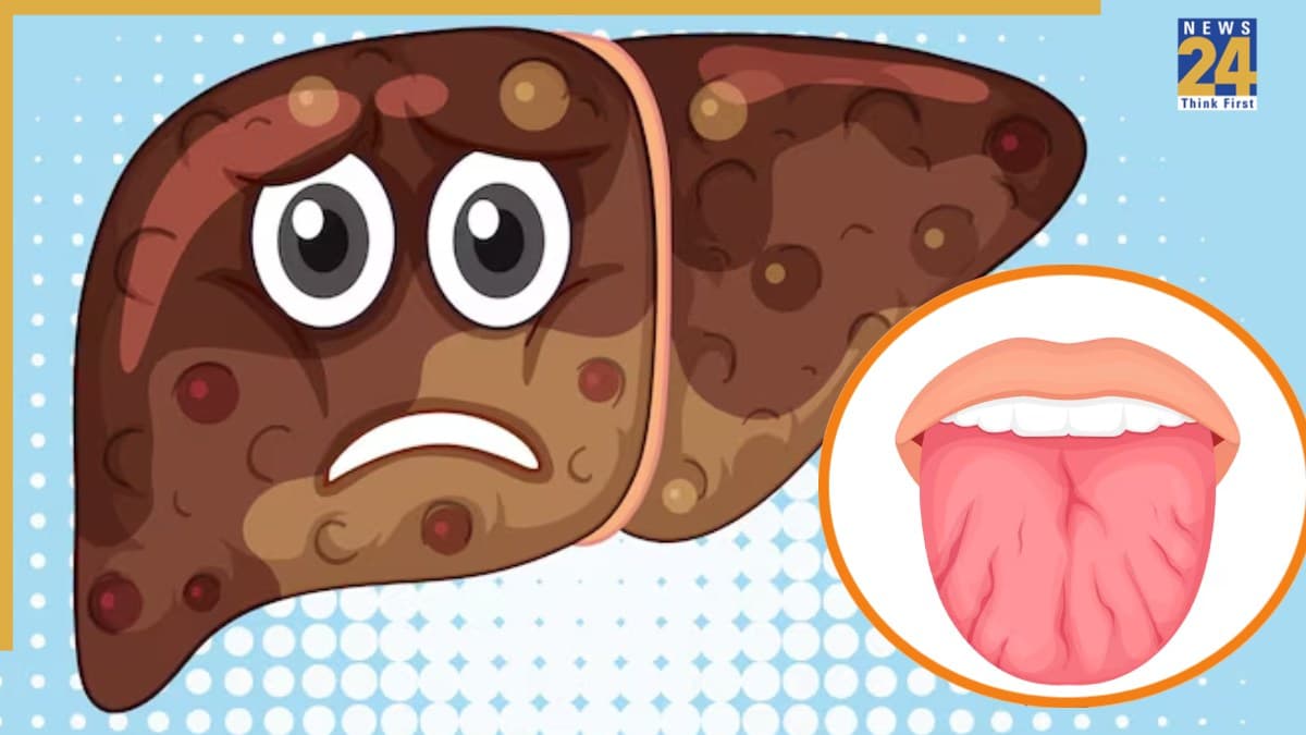 जीभ पर दिखने वाला ये संकेत Liver की बीमारी का लक्षण, डॉक्टर ने बताया कैसे करें इलाज