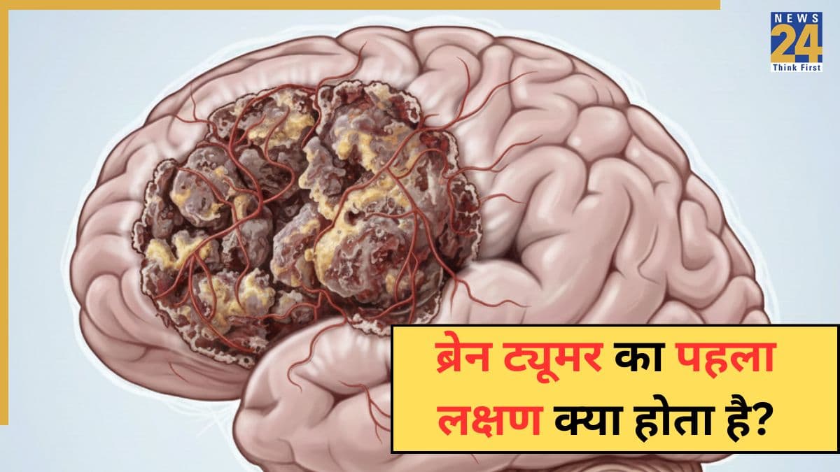 Brain Tumor का पहला लक्षण क्या होता है? मेदांता अस्पताल के डॉक्टर ने बताया कैसे पता चलेगा कि सिरदर्द ब्रेन ट्यूमर है