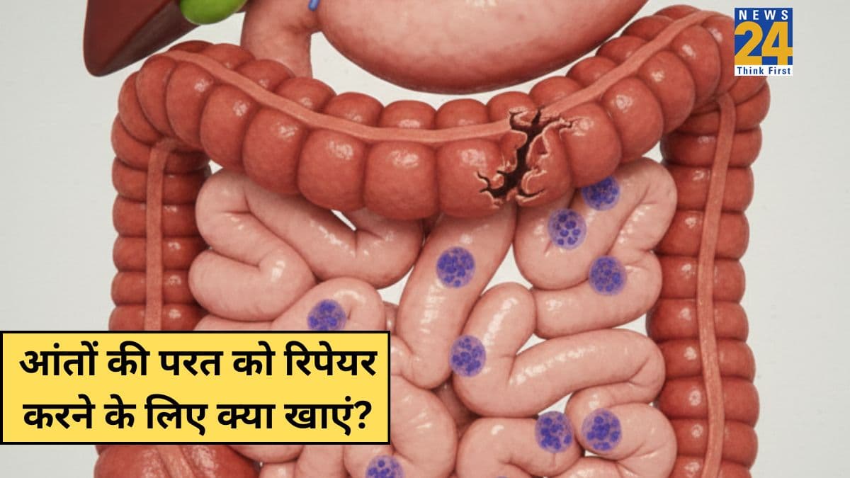 डैमेज हुई आंतों की परत को ठीक करती हैं खाने की ये 3 चीजें, डॉक्टर ने कहा रिपेयर हो जाएगी Gut Lining, लीकी गट से मिलेगी राहत