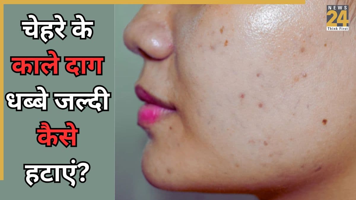 Dark Spots: सूरज की तरह चमकने लगेगा चेहरा, रोजाना इस्तेमाल करें ये 3 चीजें, कुछ ही दिनों में नजर आएगा फर्क
