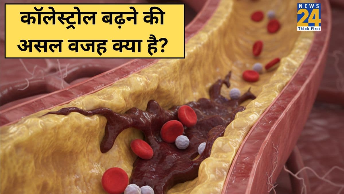कोलेस्ट्रॉल बढ़ने का मुख्य कारण क्या होता है? डॉक्टर ने बताई High Cholesterol की असल वजह