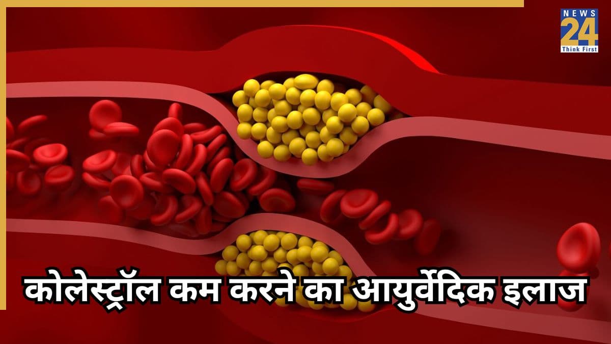नसों में जमा कोलेस्ट्रॉल तुरंत कैसे करें कम? एक्सपर्ट ने बताया आयुर्वेदिक नुस्खा, ब्रेकफास्ट से 30 मिनट पहले खाएं ये मिश्रण