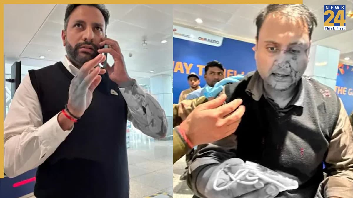 एयर इंडिया एक्सप्रेस के पायलट ने पैसेंजर के साथ की मारपीट, सोशल मीडिया पर शेयर की तस्वीर, हुआ सस्पेंड