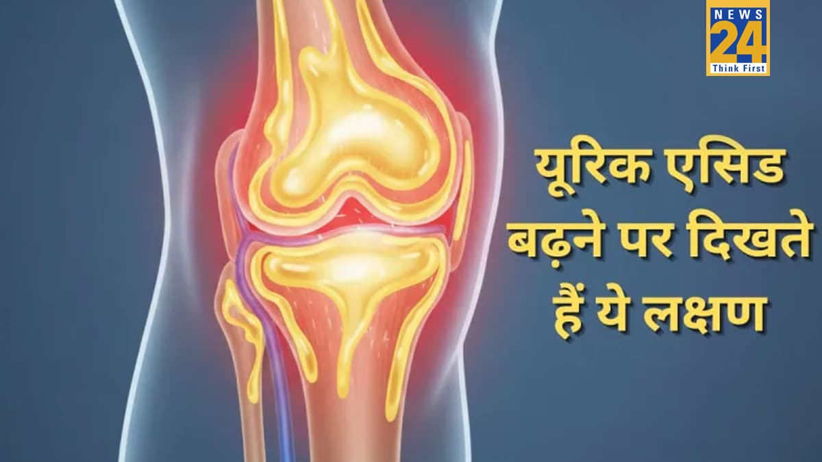 कैसे पता चलेगा कि यूरिक एसिड बढ़ा हुआ है? यहां जानिए High Uric Acid का पहला लक्षण क्या है
