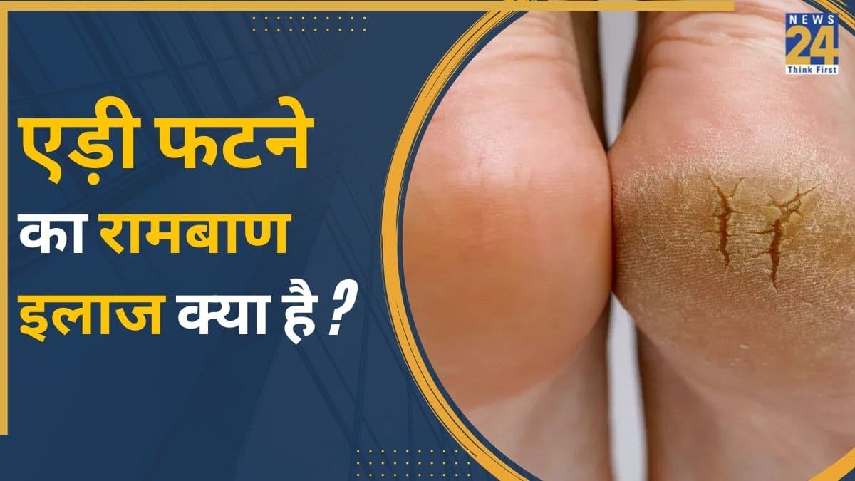 Cracked Heels: फटी एड़ी से खून बहने से कैसे रोकें? काम आएगा ये देसी नुस्खा, एक ही रात में महसूस होने लगेगा फर्क