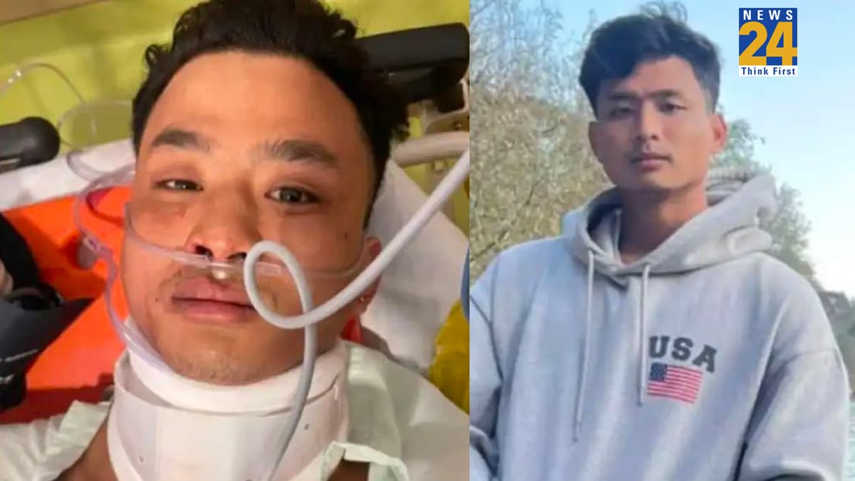 पीट-पीटकर तोड़ी रीढ़ की हड्डी, ब्रेन में ब्लीडिंग… त्रिपुरा के छात्र एंजेल चकमा की मेडिकल रिपोर्ट से रूह कंपाने वाले खुलासे