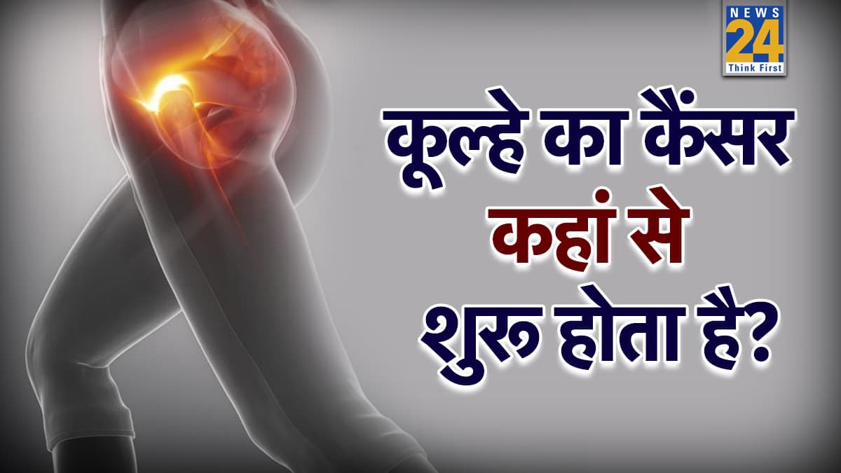 कूल्हे की हड्डी में कैंसर के क्या लक्षण हैं? एक्सपर्ट ने बताया गंभीर रूप लेने से पहले इन 5 संकेत से करें पहचान