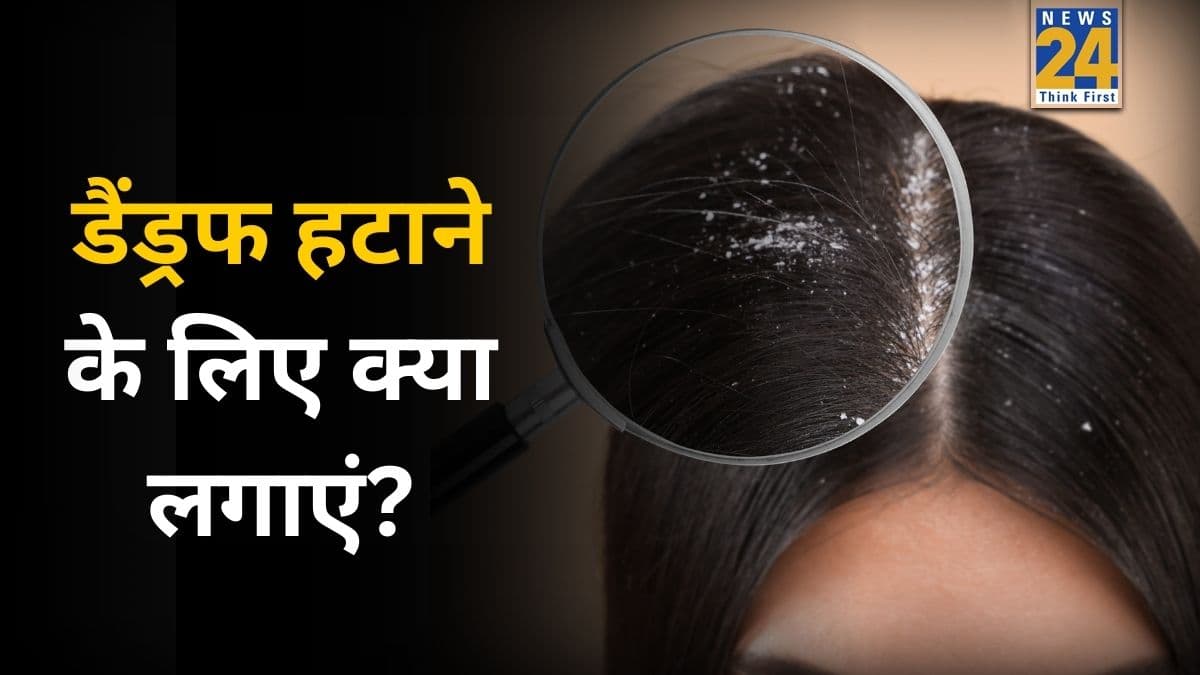 घर पर डैंड्रफ को 1 दिन में कैसे हटाएं? नारियल तेल में मिलाकर लगा ली यह चीज तो हो जाएगा रूसी का सफाया