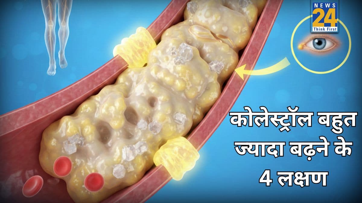 ये 4 लक्षण बताते हैं कोलेस्ट्रॉल हो गया है आउट ऑफ कंट्रोल, इन संकेतों को भूल से भी ना करें अनदेखा