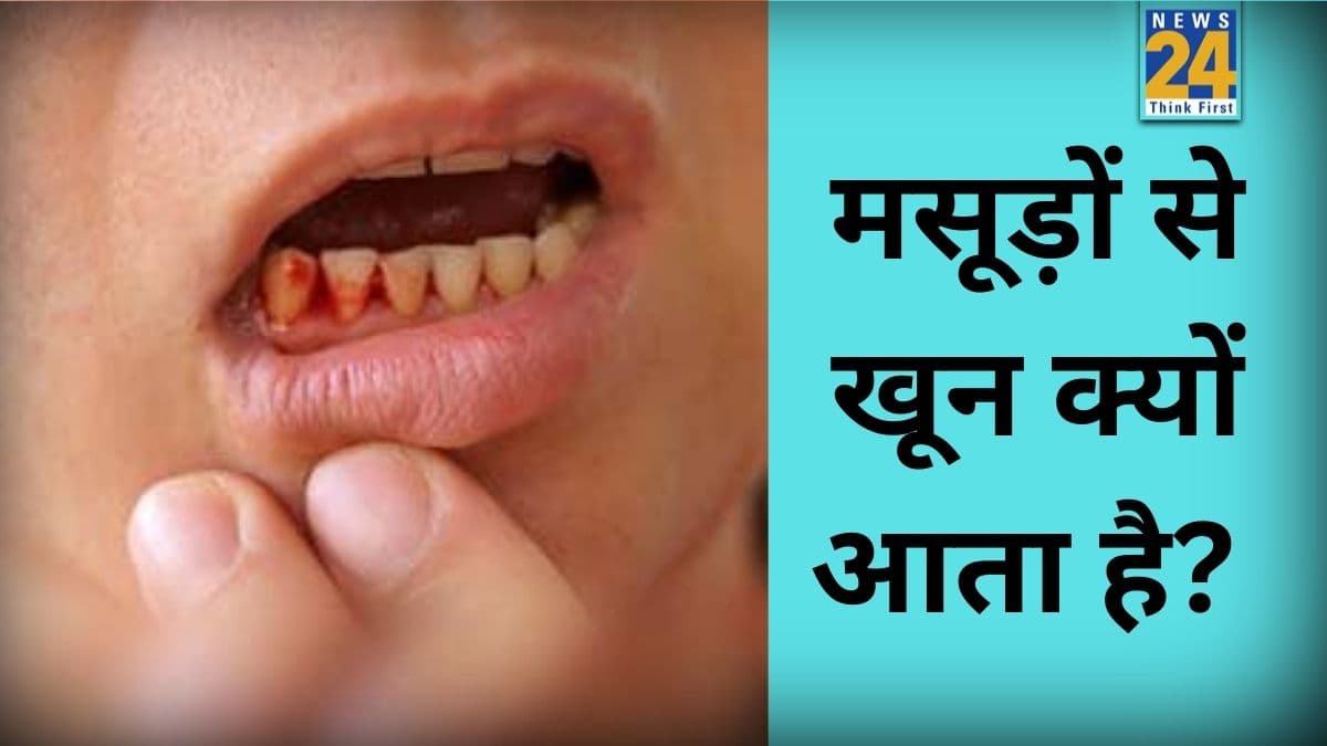 Oral Health: मसूड़ों से खून आना होगा बंद, सिर्फ 45 दिनों तक इस्तेमाल करें हरे रंग की ये जादुई औषधि 