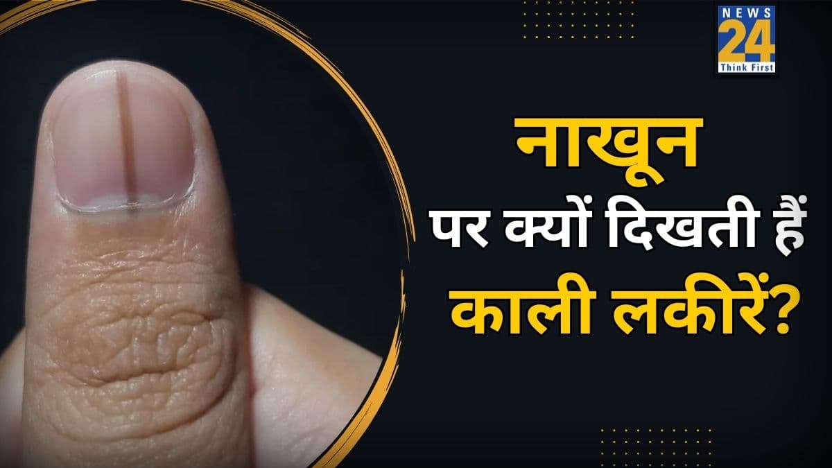नाखूनों पर काली लकीर का क्या मतलब है? जानिए यह किस बीमारी का लक्षण है और किस विटामिन की कमी इसकी वजह बनती है