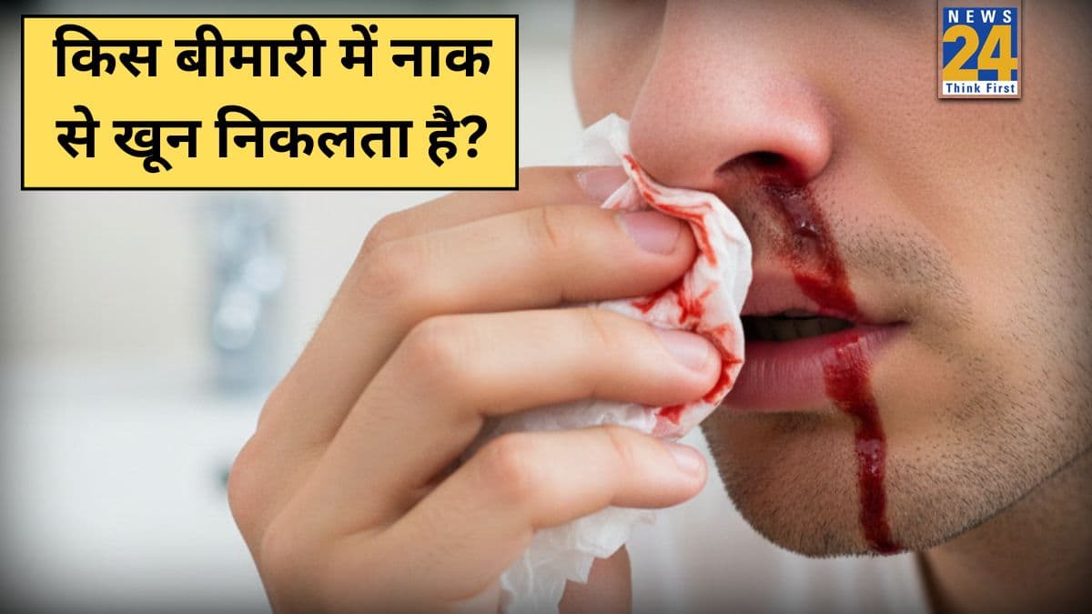 Naak Se Khoon Aana