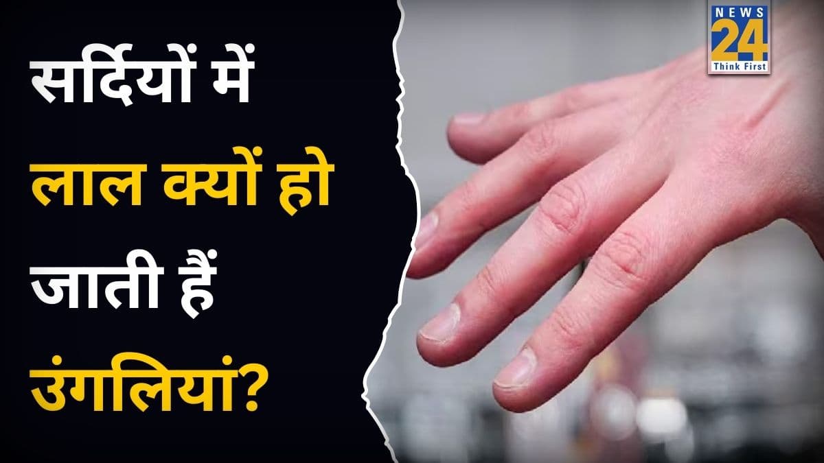 सर्दियों में उंगलियां क्यों हो जाती हैं लाल? क्या किसी तरह के इंफेक्शन का हैं खतरा