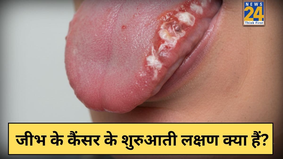 स्टेज 1 जीभ कैंसर क्या है? जानिए क्या जीभ का कैंसर पूरी तरह ठीक हो सकता है या नहीं